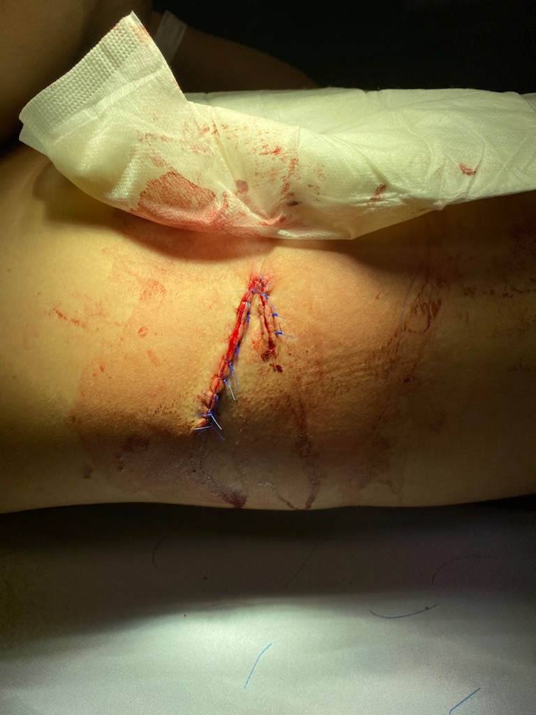 Landon Roberts praised the work of medical staff in Winkler for their efforts to stitching up his skate blade cut. (Submitted Photo)